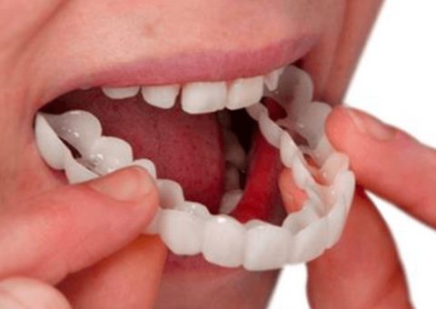 Próteses dentárias, o que avaliar antes de realizar o procedimento